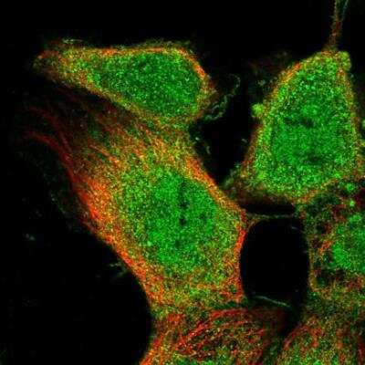 Immunocytochemistry/ Immunofluorescence: LOX-1/OLR1 Antibody [NBP2-76543]