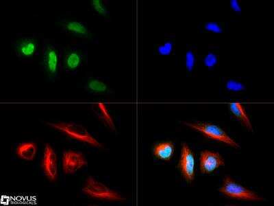 Immunocytochemistry/ Immunofluorescence: LOX Antibody [NB100-2527]