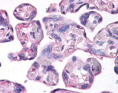 Immunohistochemistry: LOX Antibody - BSA Free [NB100-2530]