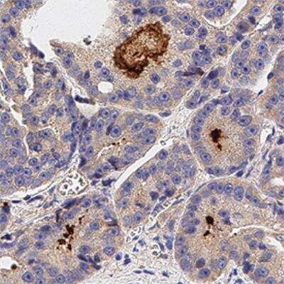 Immunohistochemistry-Paraffin: LPAR1/LPA1/EDG-2 Antibody - BSA Free [NBP1-03363]