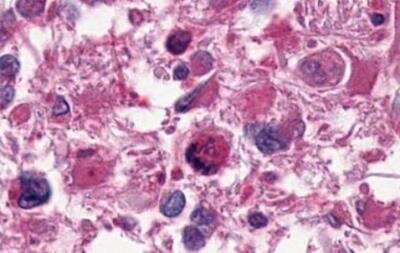 Immunohistochemistry-Paraffin: LPAR1/LPA1/EDG-2 Antibody - BSA Free [NLS212]