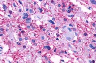 Immunohistochemistry-Paraffin: LPAR6/P2RY5 Antibody - BSA Free [NLS850]