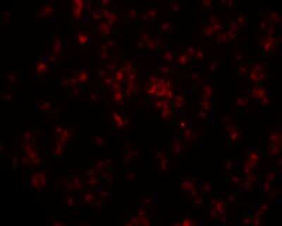 Immunocytochemistry/ Immunofluorescence: LPCAT2 Antibody [NBP1-88921]