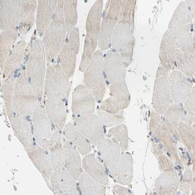 Immunohistochemistry-Paraffin: LPCAT2 Antibody [NBP1-88921]