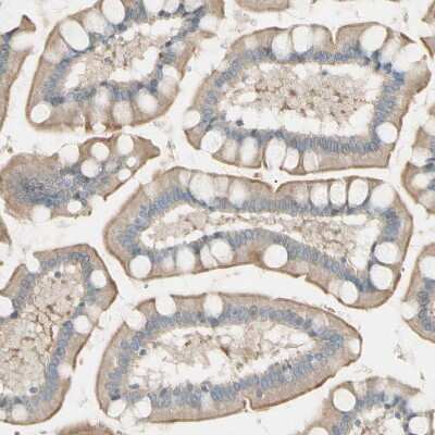 Immunohistochemistry-Paraffin: LPCAT2 Antibody [NBP1-88921]