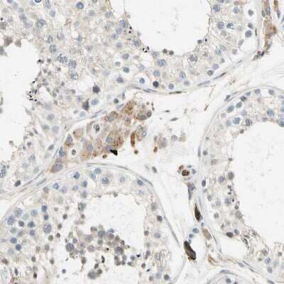 Immunohistochemistry-Paraffin: LPCAT2 Antibody [NBP1-88921]