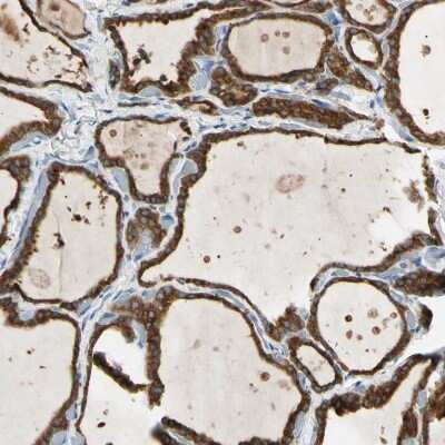 Immunohistochemistry-Paraffin: LPCAT2 Antibody [NBP1-88921]