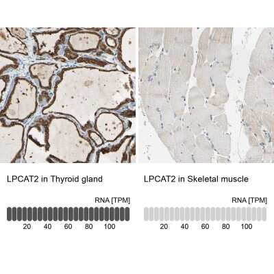 Immunohistochemistry-Paraffin: LPCAT2 Antibody [NBP1-88921]