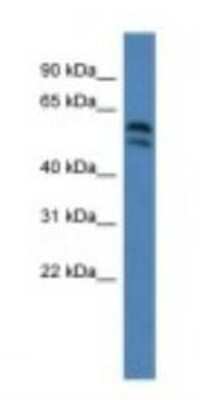 Western Blot: LPCAT2 Antibody [NBP1-79205]