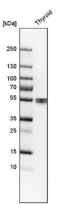 Western Blot: LPCAT2 Antibody [NBP1-88921]