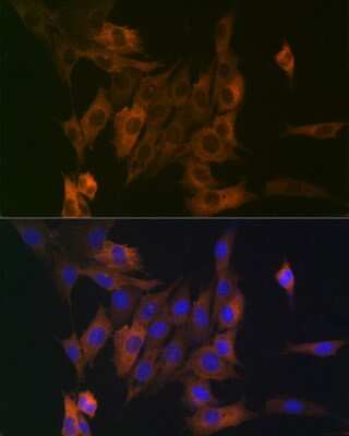 Immunocytochemistry/ Immunofluorescence: LPP Antibody (8M2R8) [NBP3-15690]