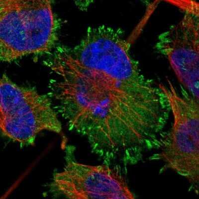 Immunocytochemistry/ Immunofluorescence: LPP Antibody [NBP1-89549]