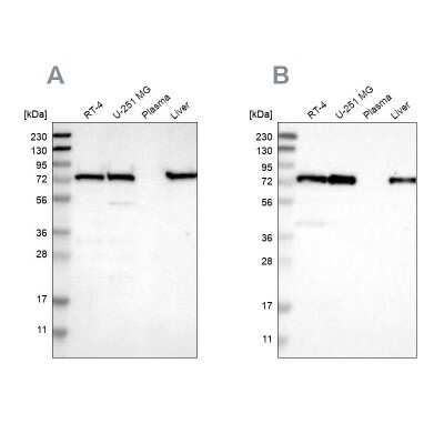 Western Blot: LPP Antibody [NBP1-89549]