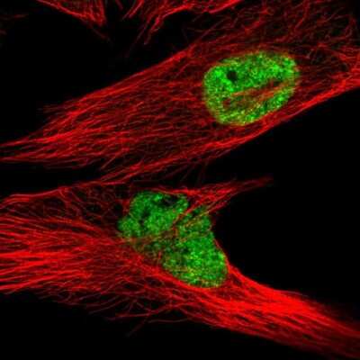 Immunocytochemistry/ Immunofluorescence: LPPR2 Antibody [NBP2-14253]