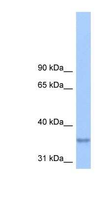 Western Blot: LPPR2 Antibody [NBP1-62301]