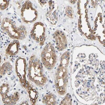 Immunohistochemistry-Paraffin: LRBA Antibody [NBP1-90765]