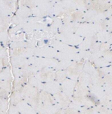 Immunohistochemistry-Paraffin: LRBA Antibody [NBP1-90765]