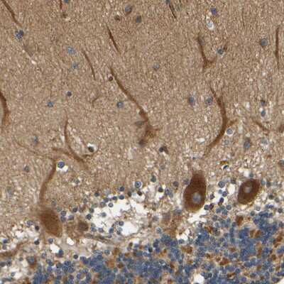 Immunohistochemistry-Paraffin: LRCH3 Antibody [NBP1-81083]