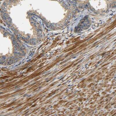 Immunohistochemistry-Paraffin: LRCH3 Antibody [NBP1-81083]