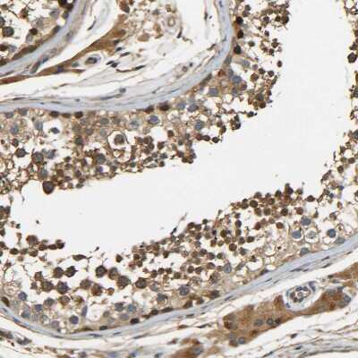 Immunohistochemistry-Paraffin: LRCH3 Antibody [NBP1-81083]