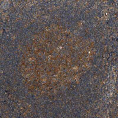 Immunohistochemistry-Paraffin: LRCH3 Antibody [NBP1-81083]