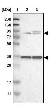 Western Blot: LRCH3 Antibody [NBP1-81083]
