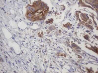 Immunohistochemistry: LRCH4 Antibody (OTI1F8) [NBP2-45795]
