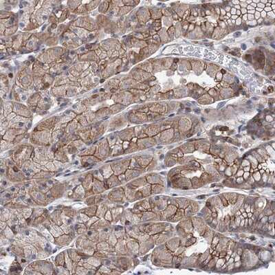 Immunohistochemistry-Paraffin: LRCH4 Antibody [NBP1-81288]