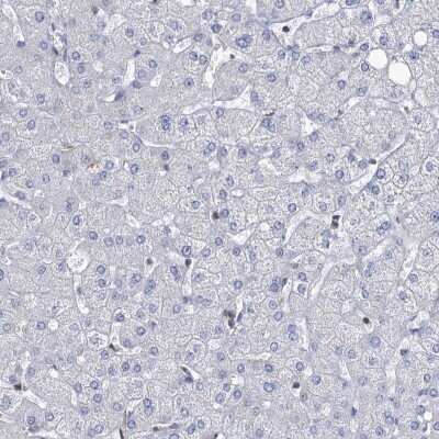 Immunohistochemistry-Paraffin: LRCH4 Antibody [NBP1-81288]