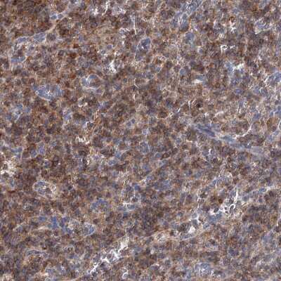 Immunohistochemistry-Paraffin: LRCH4 Antibody [NBP1-81288]
