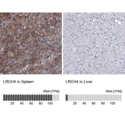 Immunohistochemistry-Paraffin: LRCH4 Antibody [NBP1-81288]