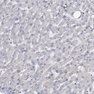 Immunohistochemistry-Paraffin: LRCH4 Antibody [NBP1-82821]