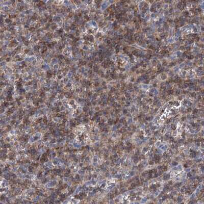 Immunohistochemistry-Paraffin: LRCH4 Antibody [NBP1-82821]