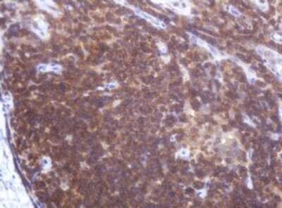 Immunohistochemistry: LRCH4 Antibody (OTI1F8) - Azide and BSA Free [NBP2-72520]