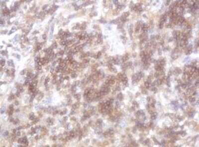 Immunohistochemistry: LRCH4 Antibody (OTI1F8) - Azide and BSA Free [NBP2-72520]