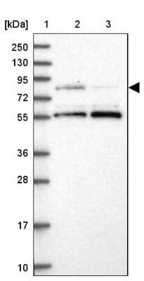 Western Blot: LRCH4 Antibody [NBP1-82821]