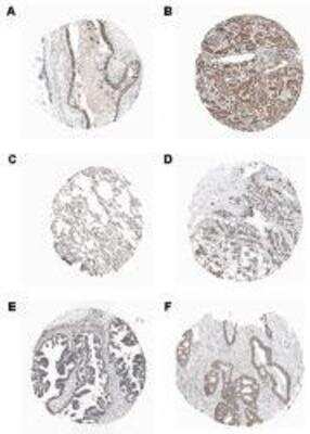 Immunohistochemistry-Paraffin: PIDD Antibody (Anto-1) - BSA Free [NBP1-97595]