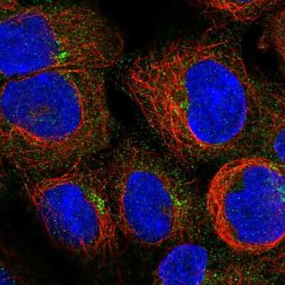 Immunocytochemistry/ Immunofluorescence: PIDD Antibody [NBP2-56216]