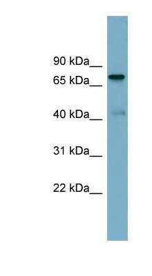 Western Blot: PIDD Antibody [NBP1-57991]
