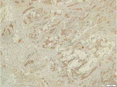 Immunohistochemistry-Paraffin: LRG1 Antibody [NBP2-19372]