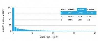 Protein Array: LRG1 Antibody (LRG1/4882) [NBP3-13851]