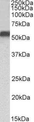 Western Blot: LRH-1/NR5A2 Antibody [NBP2-42513]