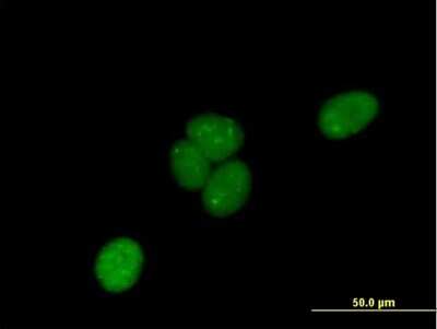 Immunocytochemistry/ Immunofluorescence: LRIF1 Antibody [H00055791-B01P]