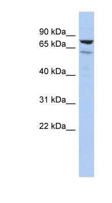 Western Blot: LRIF1 Antibody [NBP1-56659]