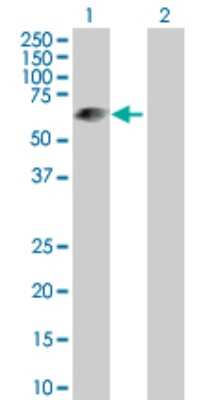 Western Blot: LRIT3 Antibody [H00345193-D01P]