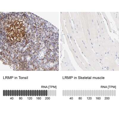 Immunohistochemistry-Paraffin: LRMP/Jaw1 Antibody [NBP1-87724]