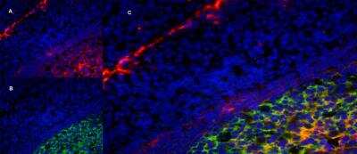 Immunofluorescence: LRP-1 Antibody (A2Mr alpha-2) - BSA Free [NB100-64808]