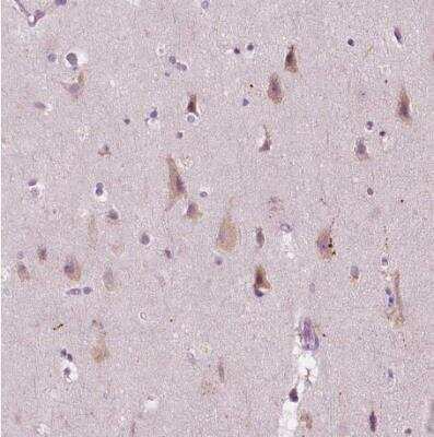 Immunohistochemistry-Paraffin: LRP-1B Antibody [NBP2-49582]