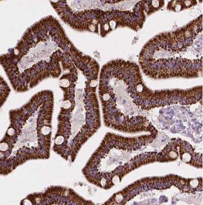 Immunohistochemistry-Paraffin: LRP-1B Antibody [NBP2-49582]