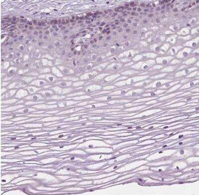 Immunohistochemistry-Paraffin: LRP-1B Antibody [NBP2-49582]